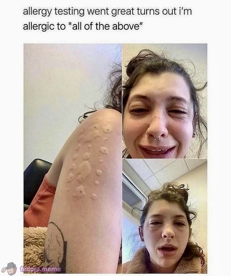 Allergies